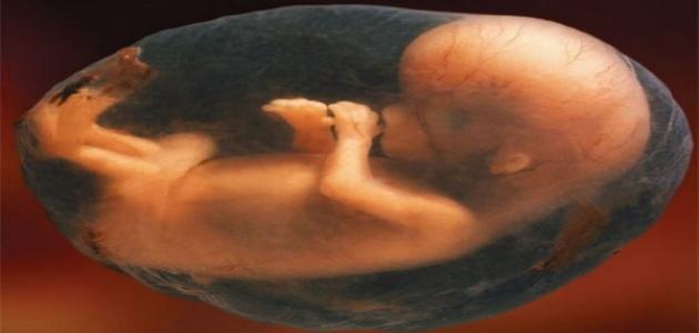 صورة جديد ما حكم اجهاض الجنين المشوه