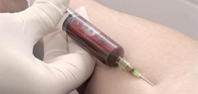 صورة جديد ما هو WBC في تحليل الدم