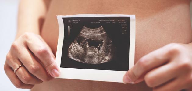 صورة جديد تكوين الجنين في الشهر الخامس
