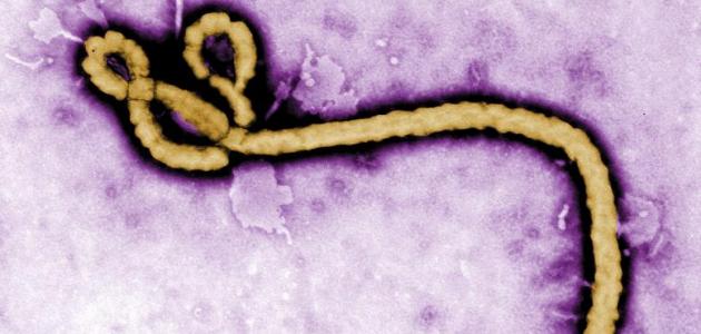 صورة جديد ما هو فيروس الإيبولا