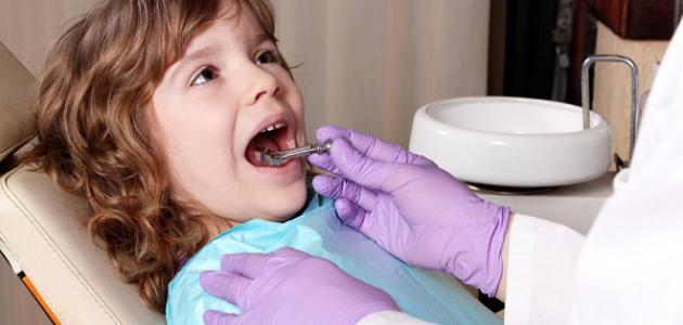 603d2d6899425 جديد أسباب تسوس الأسنان عند الأطفال