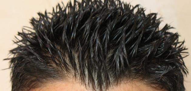 صورة جديد كيفية زيادة نمو شعر الرأس بسرعة