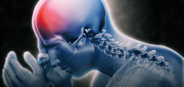 صورة جديد ما هي أعراض النزيف الداخلي في الرأس