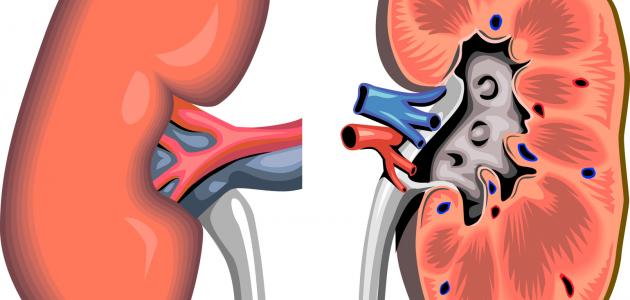 603fac5478240 جديد ما هي أعراض الفشل الكلوي
