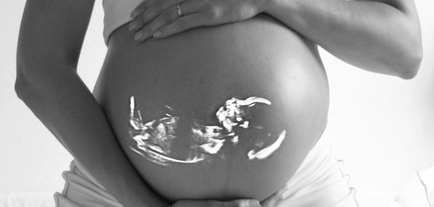 صورة جديد أضرار تسمم الحمل على الجنين