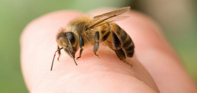 صورة جديد علاج حساسية لسع النحل