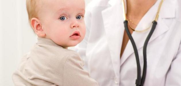 صورة جديد فقر الدم عند الأطفال الرضع