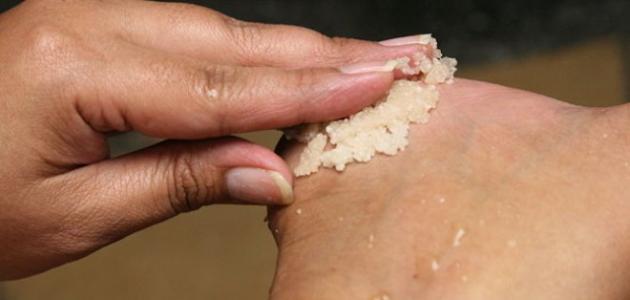 صورة جديد علاج فطريات القدم بالثوم