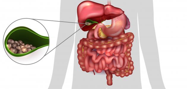 صورة جديد أمراض المرارة