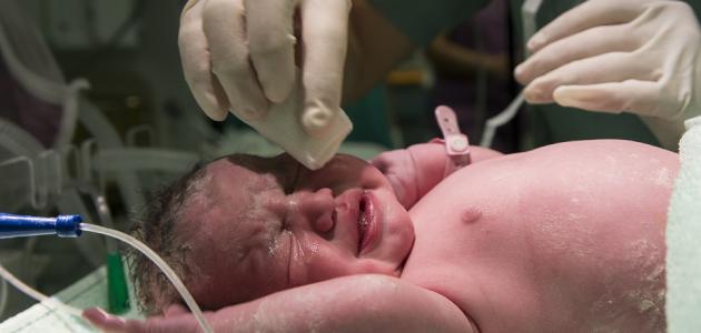 صورة جديد الولادة الطبيعية والولادة القيصرية والفرق بينهما
