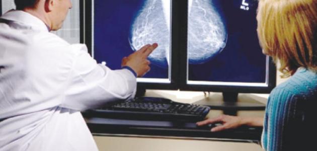 صورة جديد أين توجد كتلة سرطان الثدي
