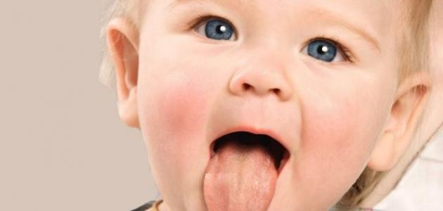 صورة جديد كيفية علاج فطريات الفم عند الأطفال