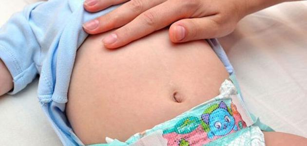 صورة جديد أسباب انتفاخ البطن عند الأطفال
