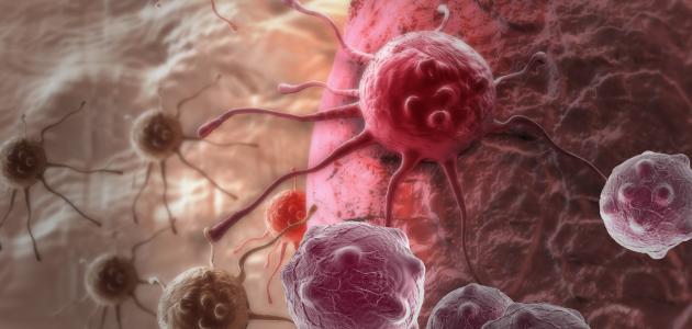 صورة جديد هل مرض السرطان وراثي