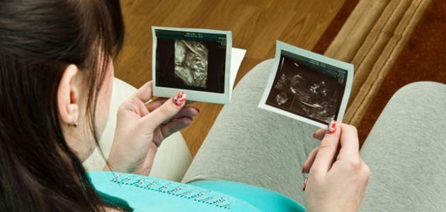 صورة جديد في أي أسبوع من الحمل ينزل رأس الجنين في الحوض