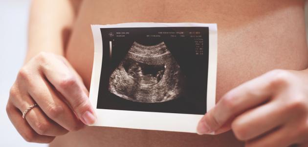 صورة جديد متى ينتهي خطر الإجهاض