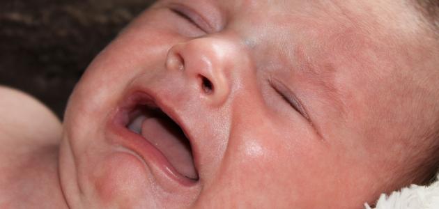 صورة جديد صعوبة الرضاعة عند الطفل