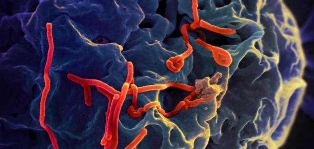 صورة جديد ما هو مرض الإيبولا