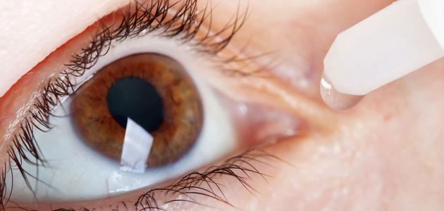 صورة جديد كيف أتخلص من حساسية العين