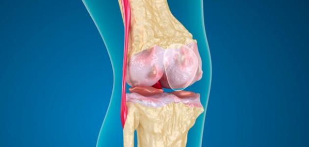 صورة جديد كيفية علاج قطع غضروف الركبة