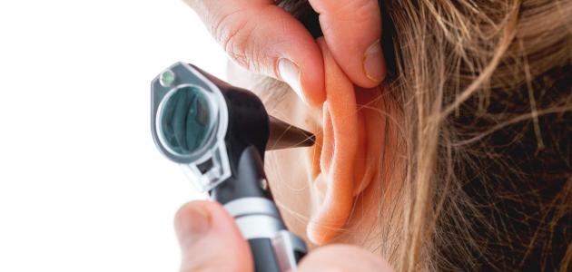 607dbf1cb7542 علاج ثقب طبلة الأذن