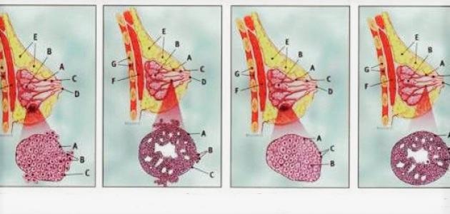 صورة مراحل تطور سرطان الثدي