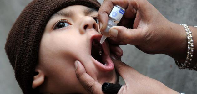 صورة ما هى أعراض شلل الاطفال