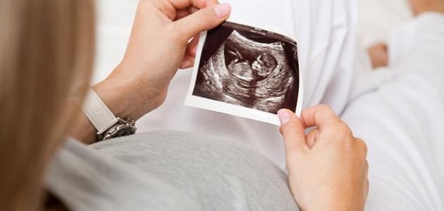 صورة علامات الحمل في الشهر الثالث