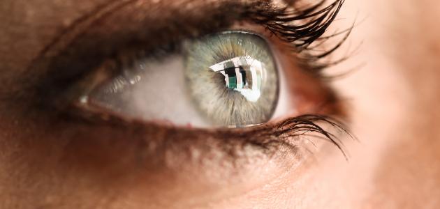 صورة أنواع حساسية العين
