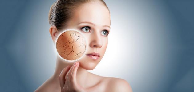 صورة علاج طبيعي لجفاف الوجه