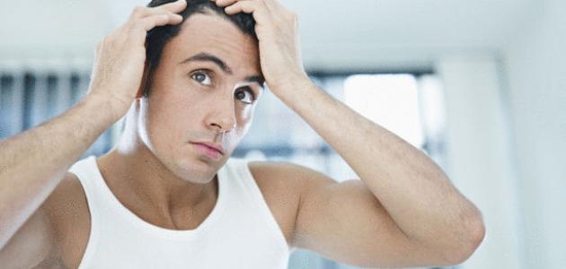صورة حل مشكلة تساقط الشعر عند الرجال