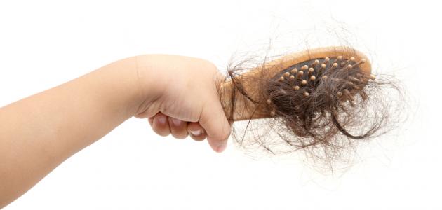 صورة ما سبب تساقط الشعر عند الأطفال