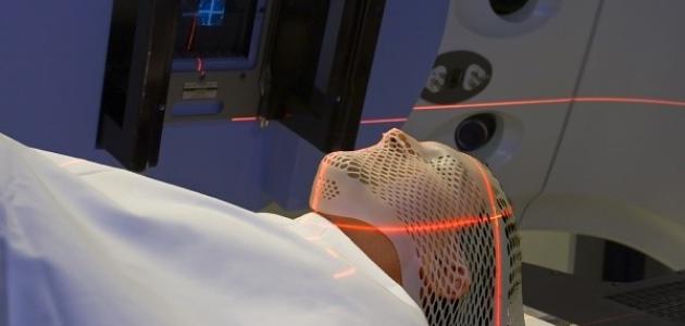 صورة الجاما نايف لعلاج أمراض وأورام الدماغ بدون جراحة – فيديو