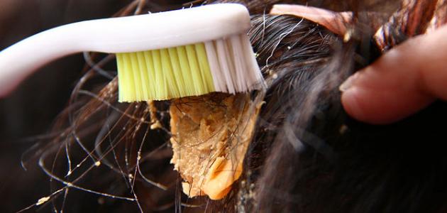 صورة طريقة إزالة اللبان من الشعر