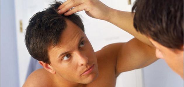 صورة كيف تحافظ على شعرك من التساقط للرجال